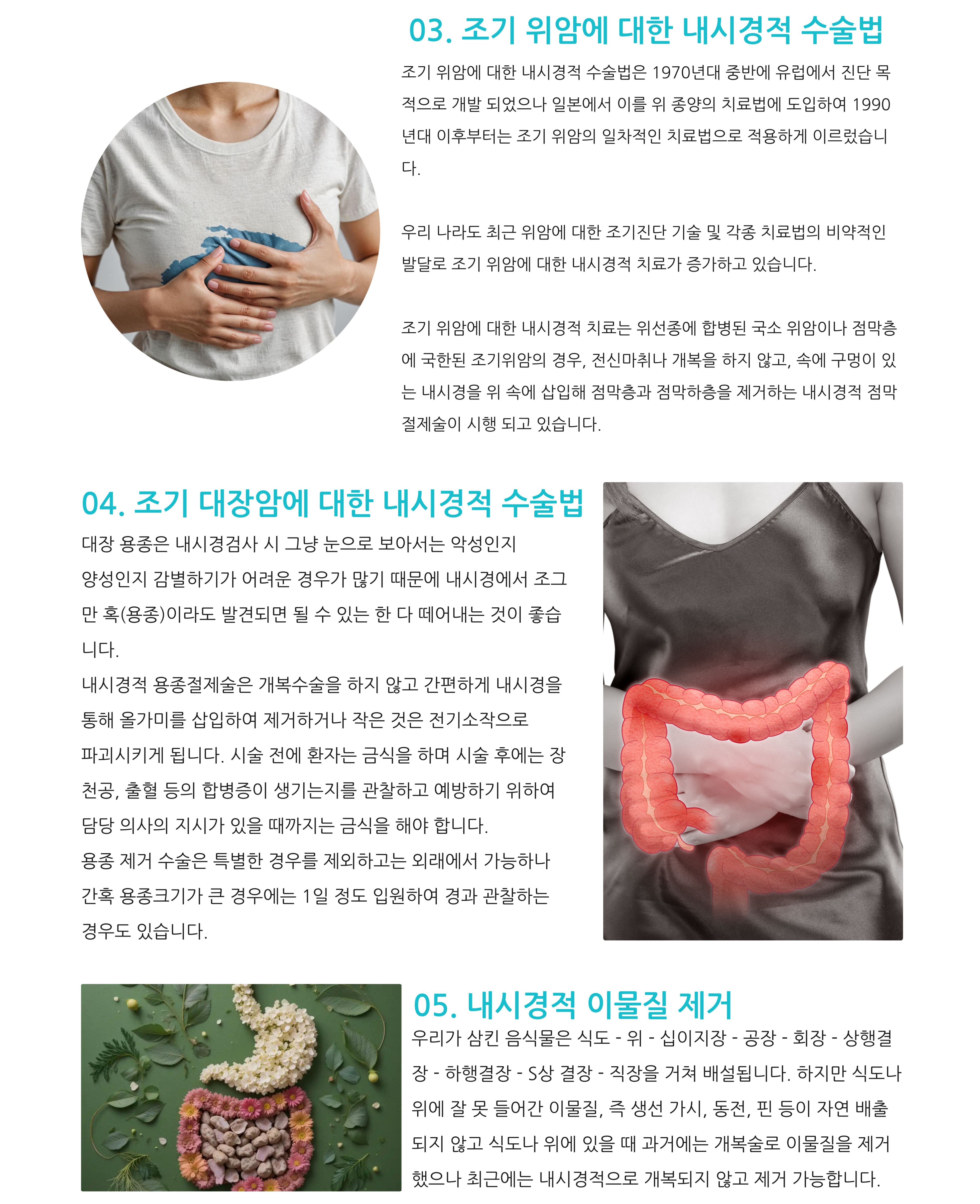 치료내시경2_복사본-_1_-001 (1).jpg