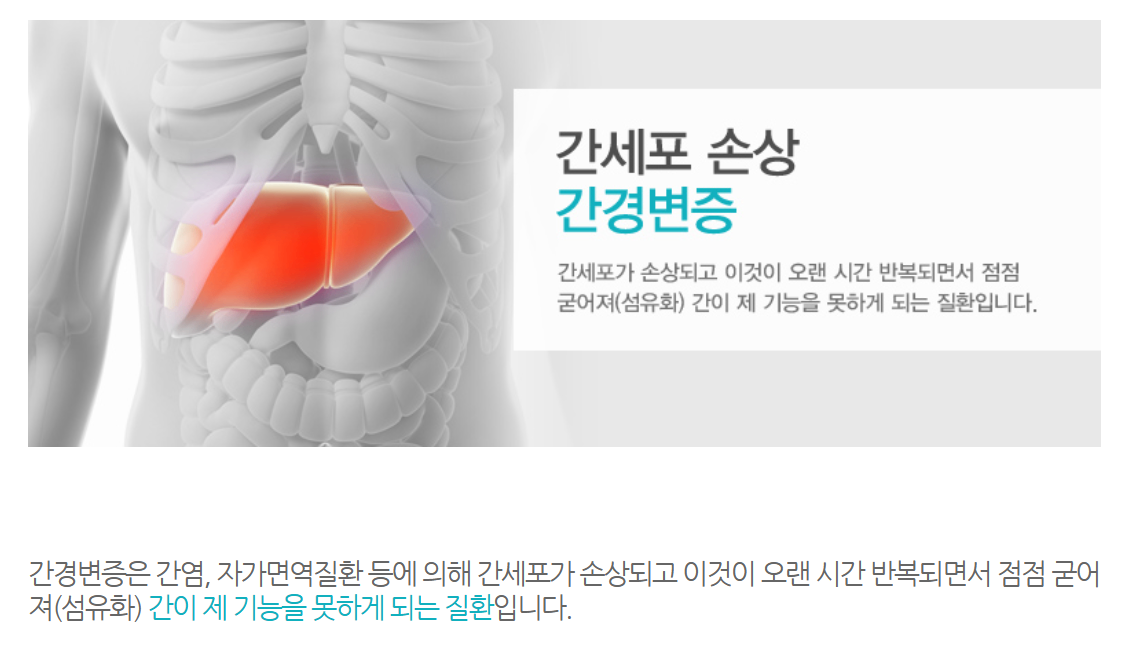 간경변.PNG